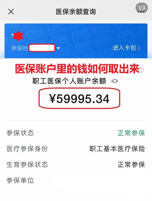 美康医保在线提取新政策解读：你的医保余额真的能随时变现吗？